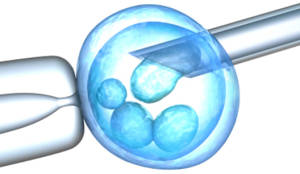 Fertilizare in vitro procedura