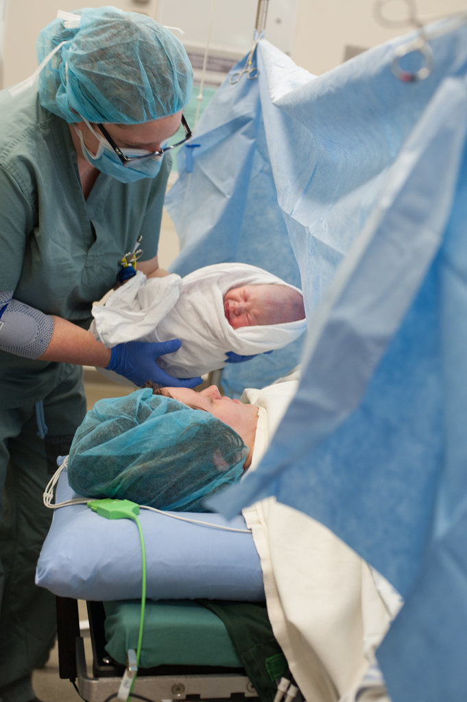 naștere prin cezariană